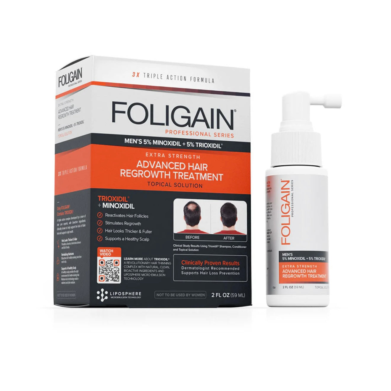 FOLIGAIN Advanced Haarwuchs für Männer Minoxidil 5 % + Trioxidil 5 %, ausreichend für 1 Monat